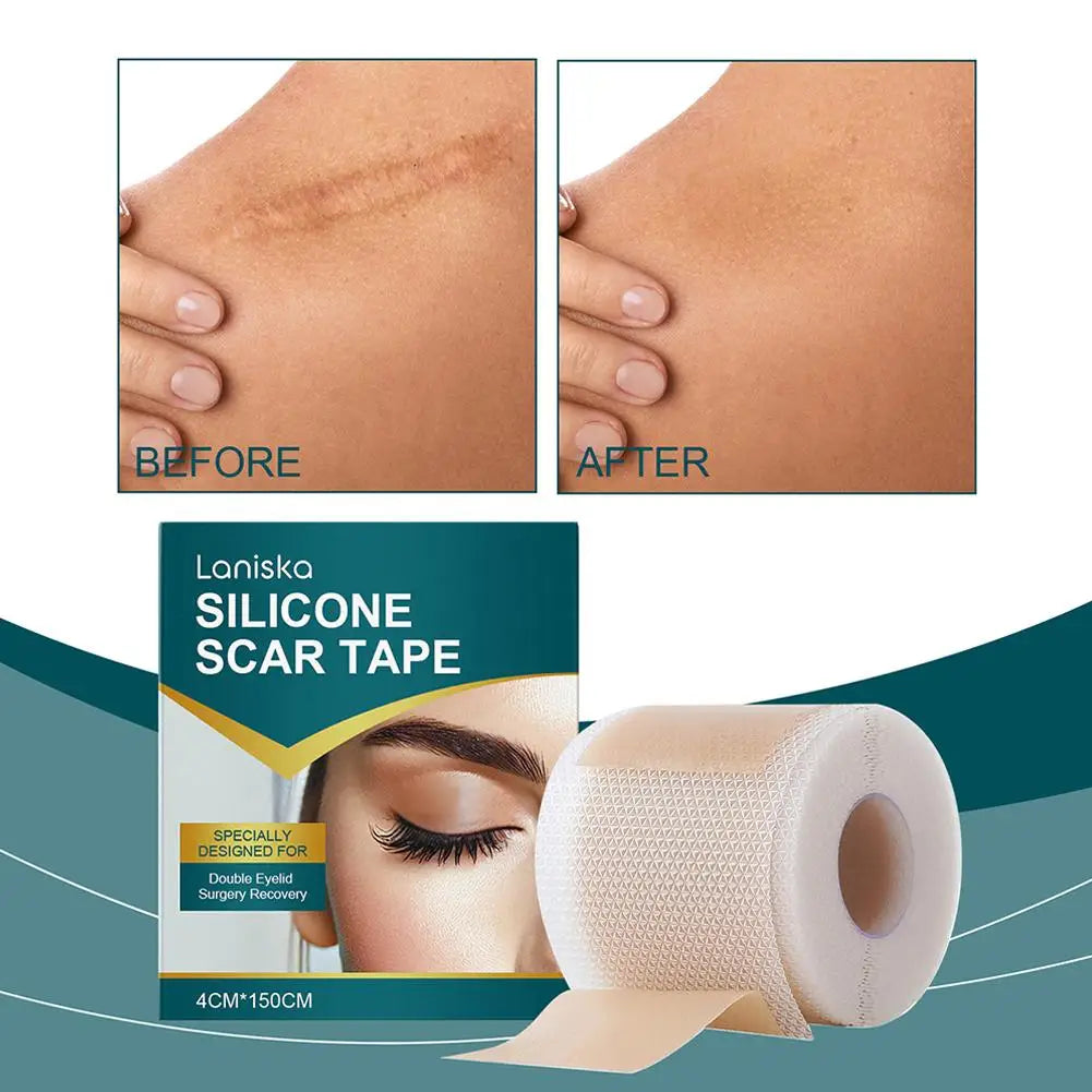 Scar Cover Patch - Silicone Gel for Eyelid & C-Section